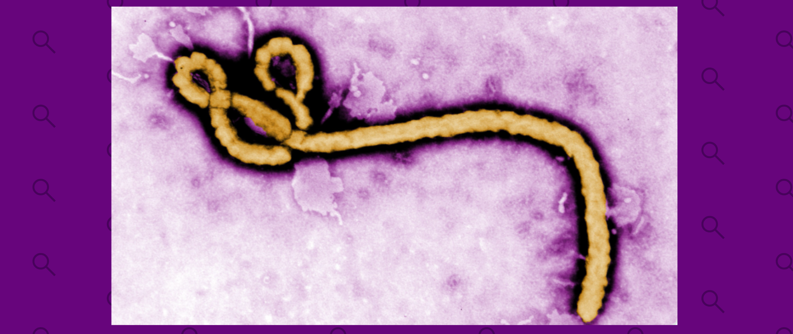 ¿Qué sabemos sobre el brote de ébola en el centro de África?