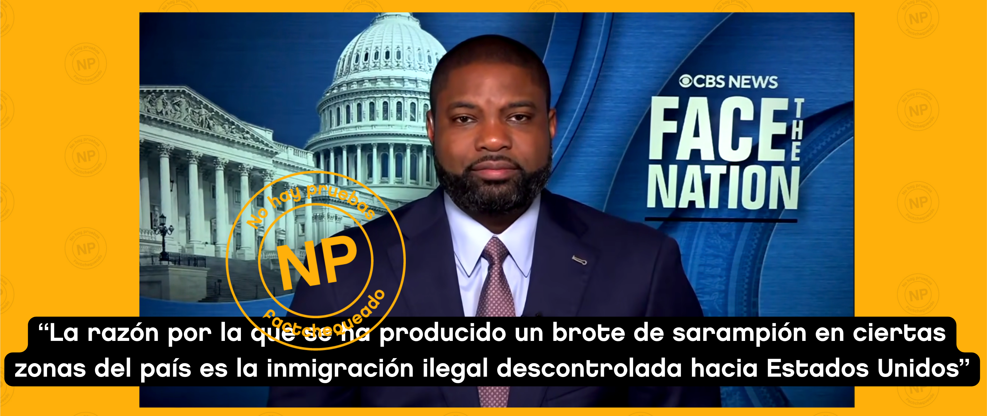 No hay pruebas de que los inmigrantes indocumentados sean los responsables del aumento de casos de sarampión en el país, como dijo el candidato republicano a gobernador en Florida, Byron Donalds